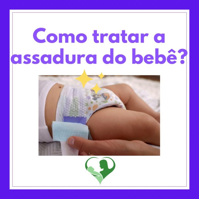 Como tratar assadura? | Clínica Gonçalves